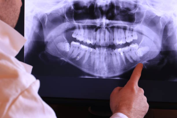 Best Emergency Dental Services for Seniors in Milroy, PA