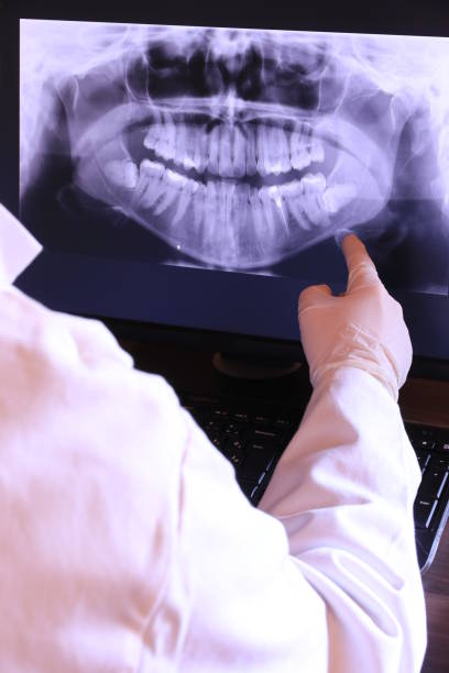 Best Emergency Dental Extractions in Milroy, PA